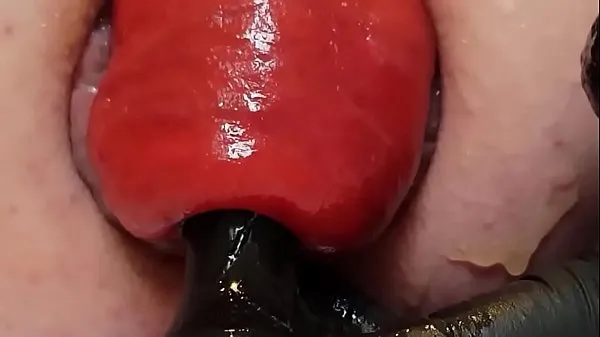 Big Contender For Biggest Prolapse (Male Warning warm Tube