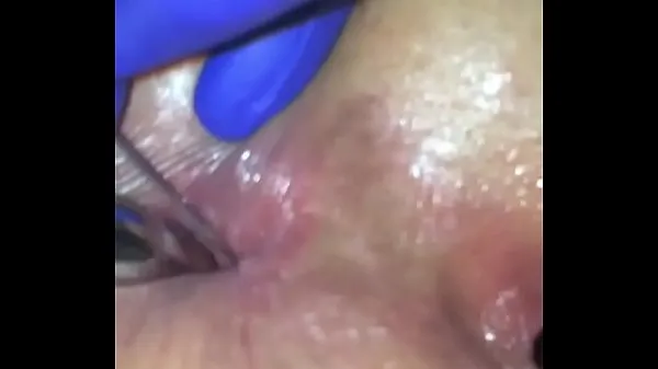 Büyük Anal injections female sıcak Tüp