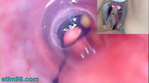 Big Mature Woman Peehole Endoscope Camera in Bladder with Balls warm Tube